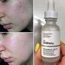 Hydrating Cream-to-Foam Cleanser+The Ordinary niacinamide Serum 🌟just 2499